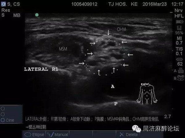 广东省梅州市丰顺县潭江镇敬老院