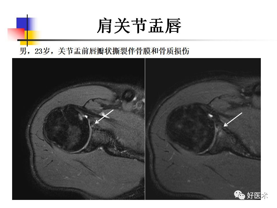 重新镇敬老院